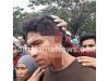 Penembakan “Gas Air Mata” Berujung Bocornya Kepala Warga, Kapolres Halmahera Utara Minta Maaf