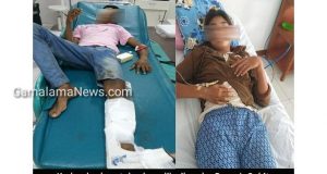 Yamaha vs Honda Blade, Warga Jailolo Patah Kaki dan Tangan